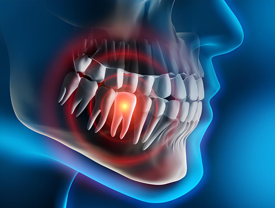 Teeth image - Emergency dentist Redhill